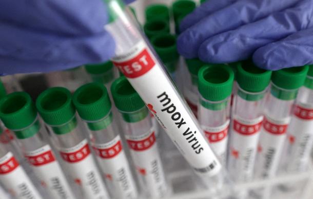 Ministry of Health awaiting results for three suspected Mpox cases