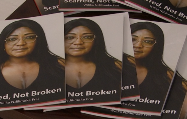 Wilika Frai shares her health challenges in “Scarred, Not Broken”